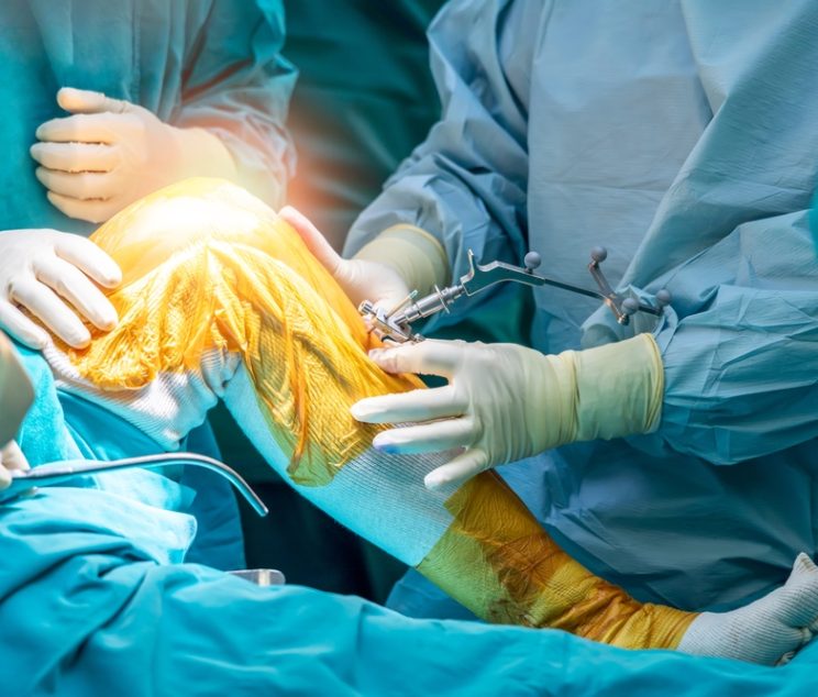 Doctor,Or,Surgeon,In,Blue,Gown,Used,Robotic,Navigator,Total